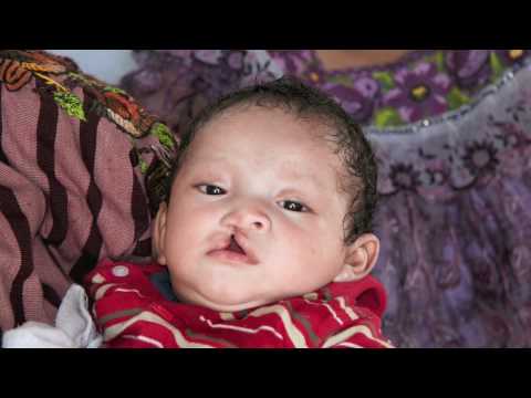 how to practice duchenne smile