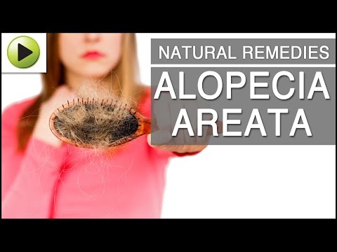 how to treat alopecia