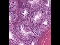 Shotgun Histology Testis