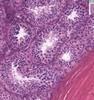 Shotgun Histology Testis