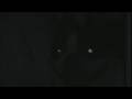 videos de Strange Animal sighted in Atlanta  ****VERY DISTURBING****