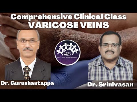 VARICOSE VEINS Clinical Case Presentation