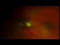 Retina.mov