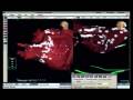 videos de Radiofrequency Catheter Ablation