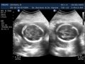 Ultrasound 103009