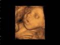 videos de ECOGRAFIA 3D Y 4D DIAGNOSALUD