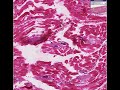 Histopathology Skeletal muscle --Trichinosis Histopathology Skeletal muscle --Trichinosis