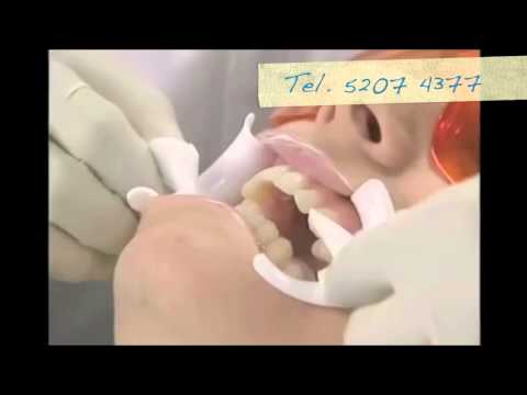 blanqueamiento genital - TE RECOMIENDO que antes de realizarte algún blanqueamiento dental, investigues y compares los diferentes procedimientos. En este video, te doy mas informació...