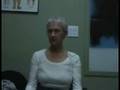 65 yo w/severe scoliosis, Spinecor Brace Testimonial