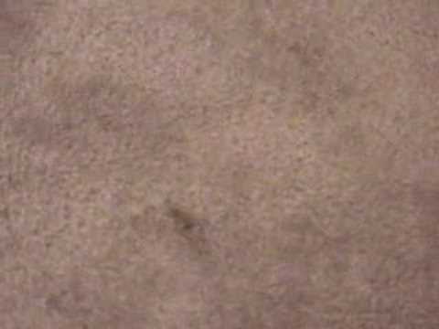 how to treat burn on a carpet