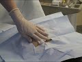 Bone Marrow Biopsy 1 Bone Marrow Biopsy 1