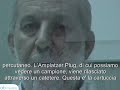 Dott. Alessandro Valdata - Il trattamento del MAV polmonare