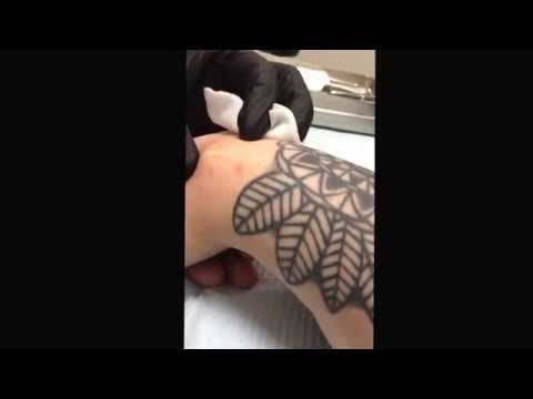 how to drain ganglion cyst
