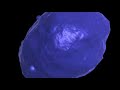 Apoptosis