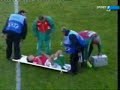 stretcher coordination