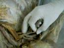 Neuroanatomia 3 Facimed Medicia