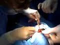 PISO ORBITA LS (3)