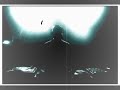 DJ OSSY ft. BASS TÜRK - yana yana (REMIX) YOUTUBE'DA ILK KEZ