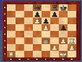 Chess Lesson #4, Part E (Tactic: Deflection)