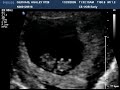 my little alien baby XD