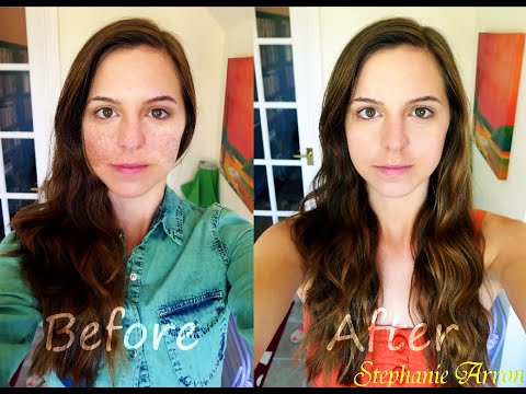 video-linktoworks-How to Get Rid of Freckles - My Experiment