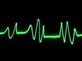 TRANCE VISIONS- Experiental - Lazarus Effect (Macramsey Hurmos Remix) full HQ