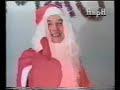 amputee christmas show 1