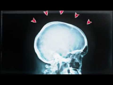 See video