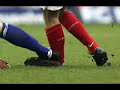Eduardo da Silva injury