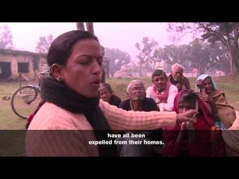 how to cure leprosy