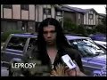 EL BARRIO-entrevista con leprosy EL BARRIO-entrevista con leprosy