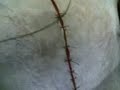 caractericacion chonis