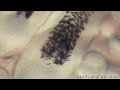 毛根の顕微鏡映像 - Root of the hair - 毛根