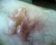 My mates gammy leg thing!!!! yuk!!!