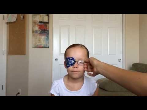 how to patch amblyopia