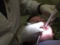Dental Procedures Demonstration