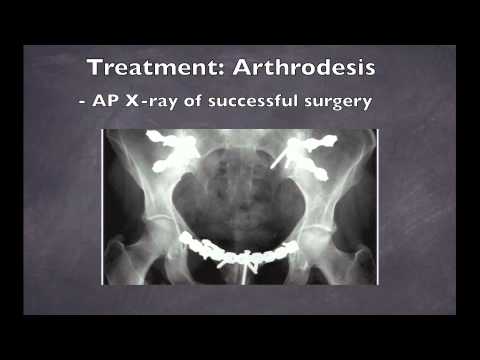 how to relieve osteitis pubis