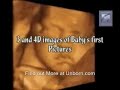 Pro-Life 4D Ultrasound Footage from Eyewitness 2 DVD Pro-Life 4D Ultrasound Footage from Eyewitness 2 DVD