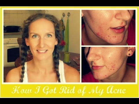 how to oil cleansing method acne