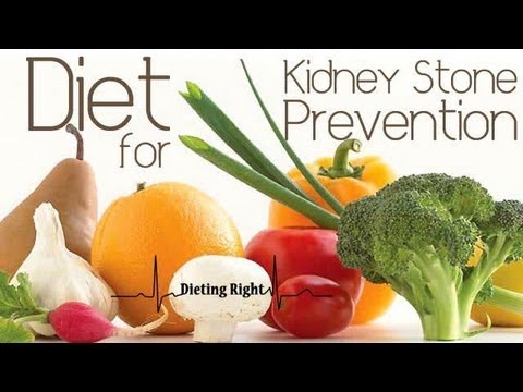 how to avoid kidney stones through diet