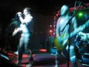 Spazmatics in Dallas