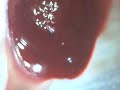 ~ MORGELLONS ~ strange movement2 ~ MORGELLONS ~ strange movement2