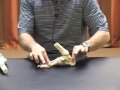 forefoot valgus