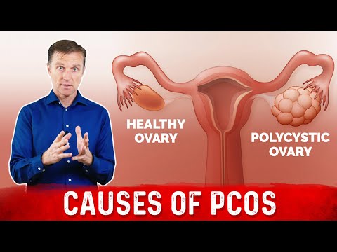 how to treat polycystic ovarian syndrome
