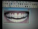 How to whiten teeth on Photofiltre! How to whiten teeth on Photofiltre!