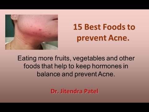 how to eat to prevent acne