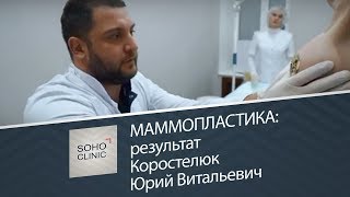 Капуста и другие овощи в питании для увеличения груди