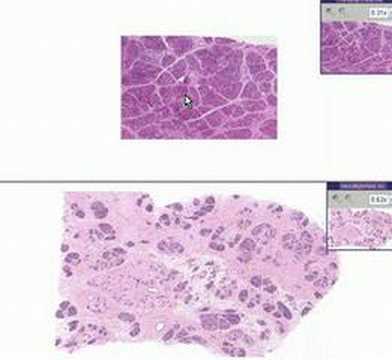 組織病理学Breast-- 授乳期の増生