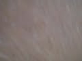 Video 8
