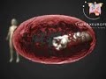 Así se realizó el primer transplante de tráquea sin fármacos